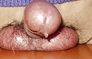 XXX चष्मा लावलेला Si पकडले कामौत्तेजित होणे पांढरा मुलगी आणि फायदा घेतला क्षण